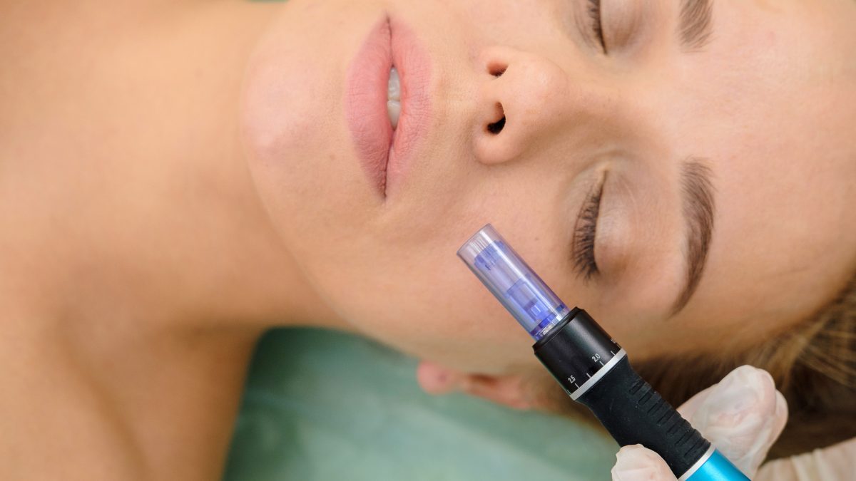 guide to microneedling