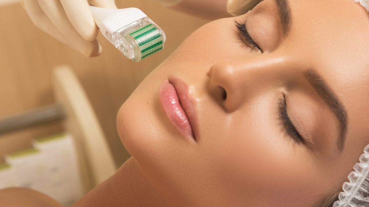 microneedling for scars