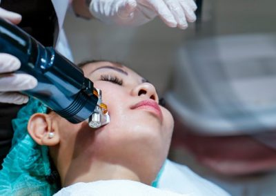 10 Common Microneedling Myths You Should Know